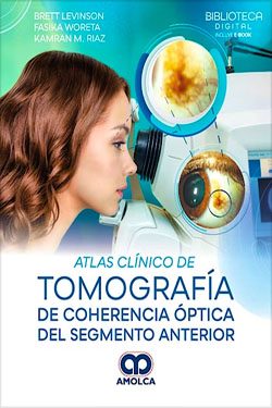 Atlas Clínico de Tomografía de Coherencia Óptica del Segmento Anterior