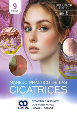Manejo Práctico de las Cicatrices