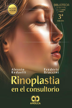 Rinoplastia en el Consultorio
