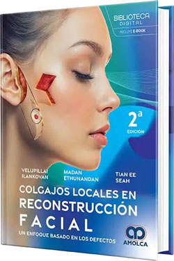 Colgajos Locales en Reconstrucci�n Facial