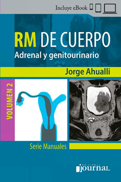RM de Cuerpo Vol 2 Adrenal y Genitourinario