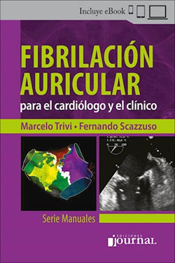 Fibrilación Auricular para el