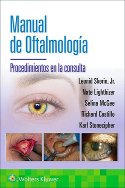 Manual de Oftalmología