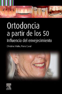 Ortodoncia a Partir de los 50