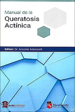 Manual de la Queratosis Actínica